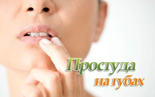 Как лечить простуду на губе быстро, в домашних условиях